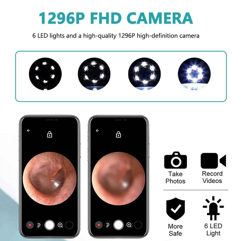 Ear Endoscope Camera, 1080P HD WiFi, Earwax Removal Tool Kit with 6 LED Lights, iOS & Android Compatible, 5 Silicone Tips( كاميرا منظار الأذن)